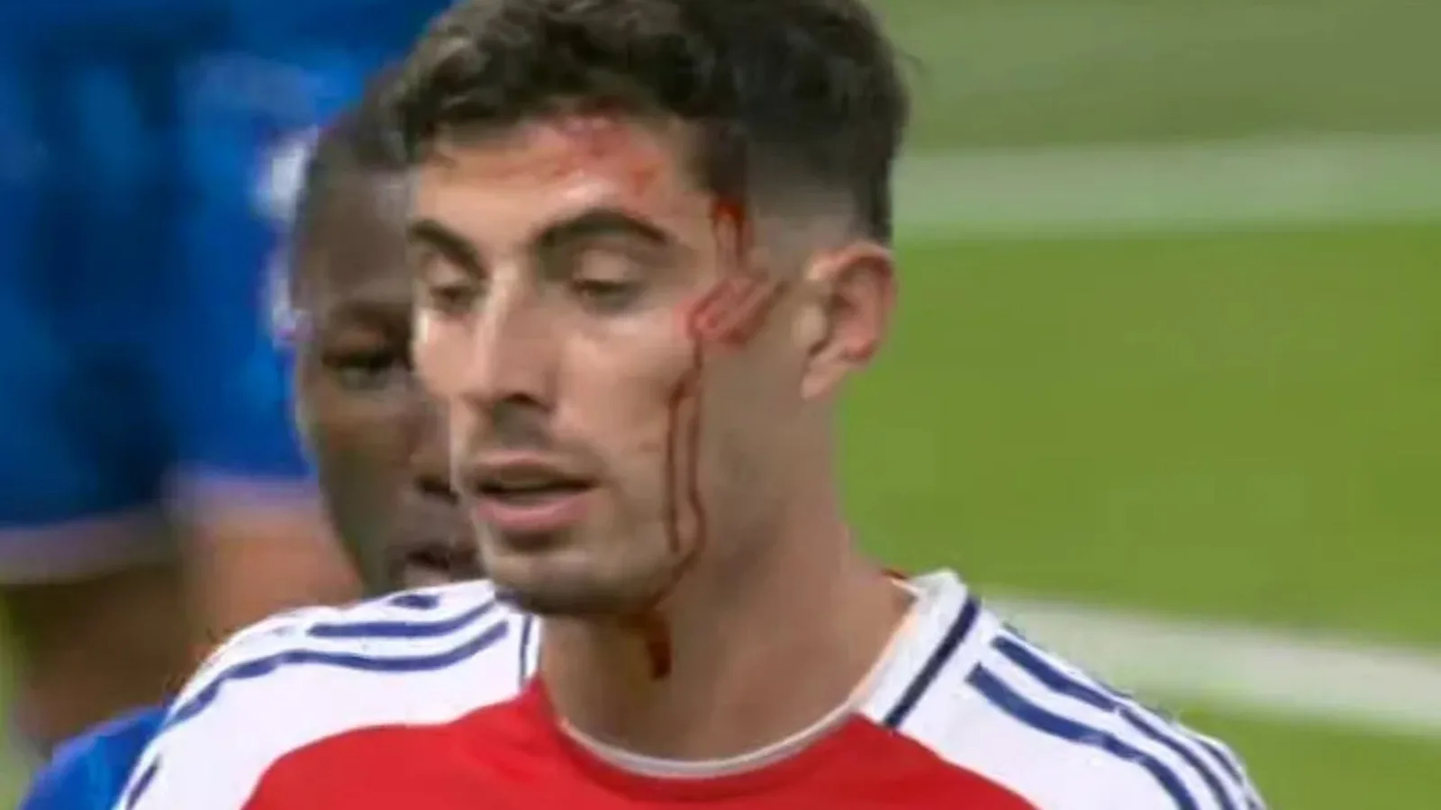 Kai Havertz est parti couvert de sang alors qu’une blessure à la tête d’horreur se rouvre avec la star d’Arsenal forcée de quitter le terrain contre Chelsea