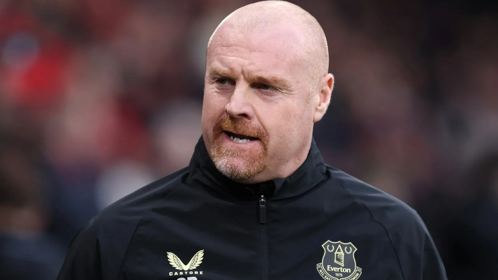 Sean Dyche révèle qu’il obtient un «  brillance  » avec un travail de nez et de nouvelles dents alors qu’il s’ouvre sur l’état de santé