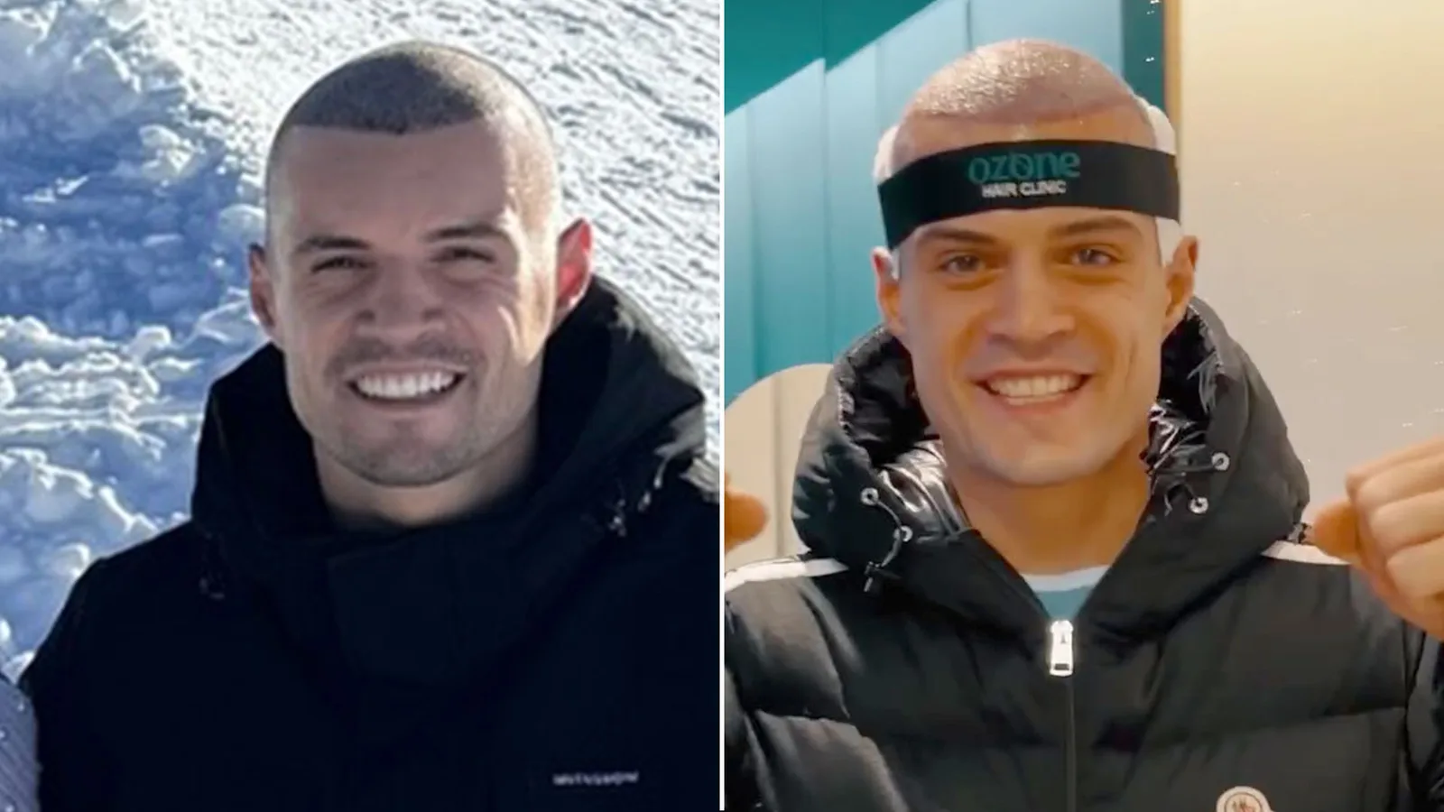 Granit Xhaka révèle la raison de son nouveau look dramatique avec l’ex-star d’Arsenal ayant subi une greffe de cheveux