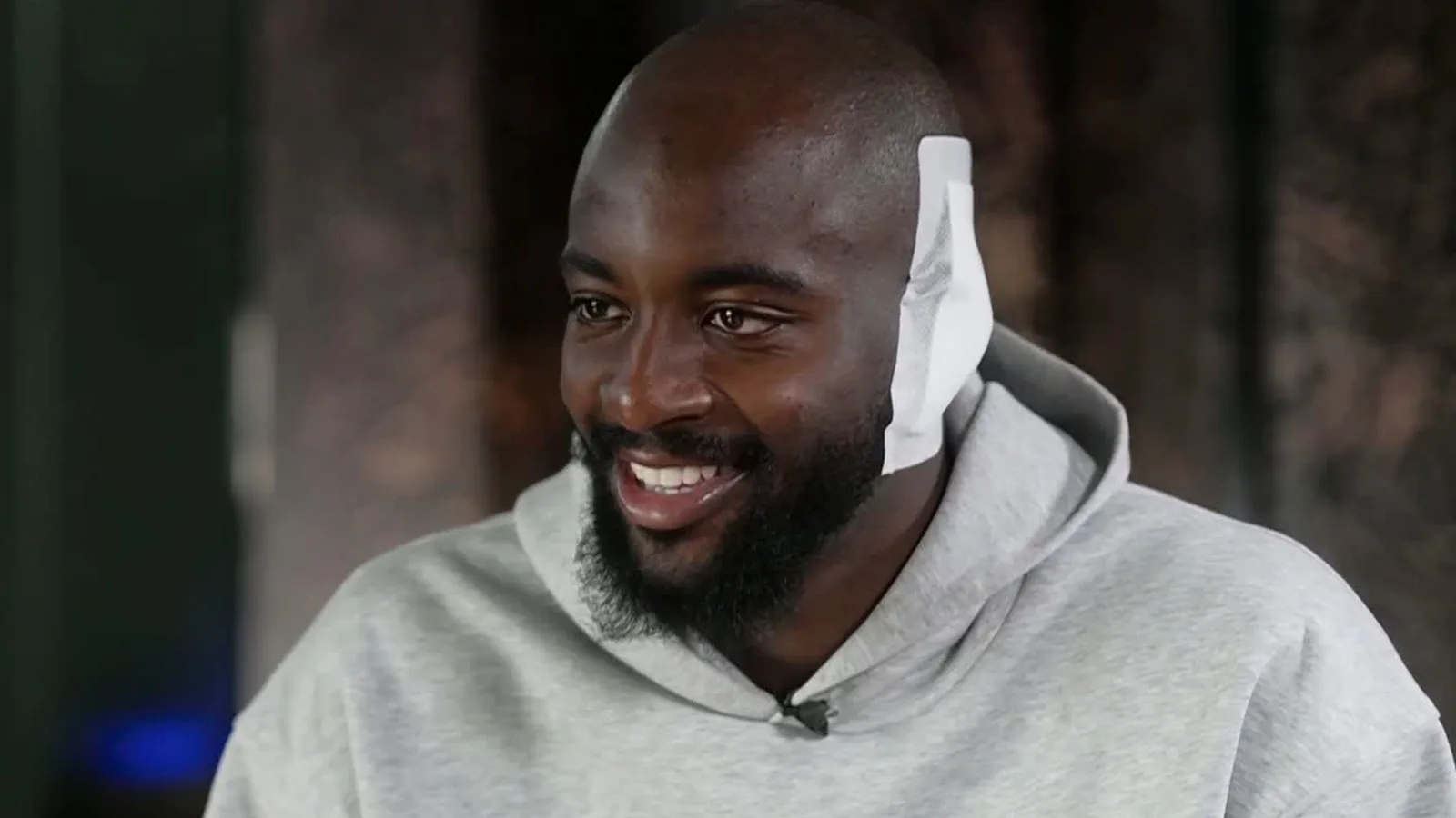 Jean-Philippe Mateta porte un énorme bandage après une blessure à l’oreille d’horreur pour que le mauvais docteur ne lui montre pas photo