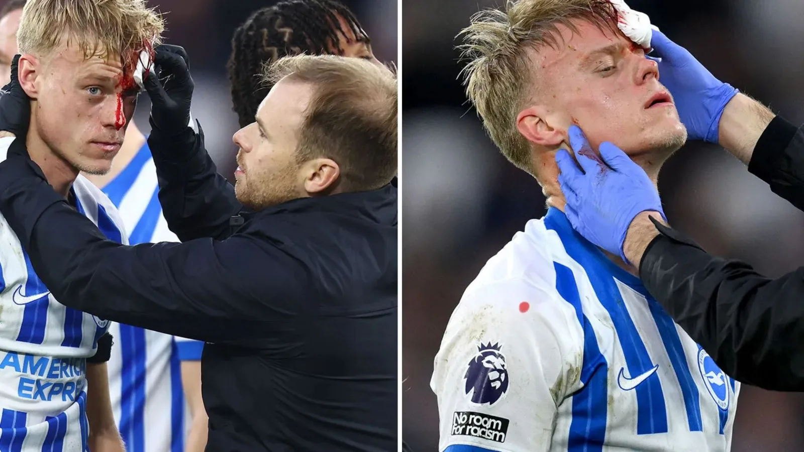 La star de Brighton, Jan Paul van Hecke, est partie avec du sang coulant sur son visage après avoir été blessée par son propre coéquipier
