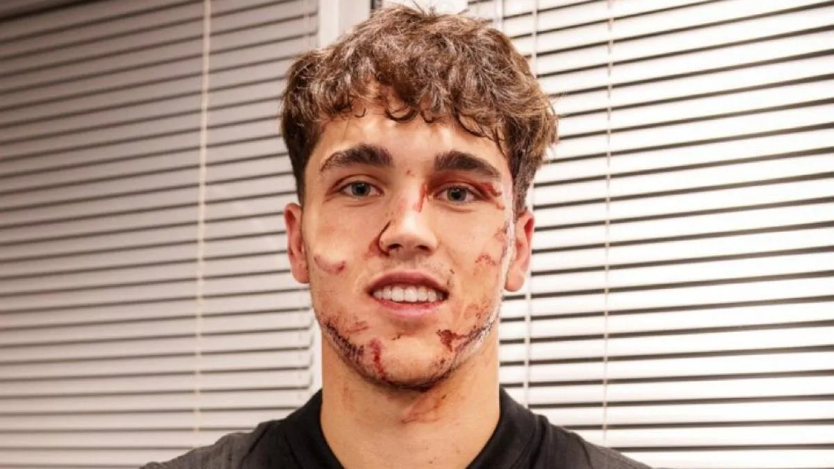 Barcelone espère un prompt rétablissement du défenseur vedette après une horrible blessure au visage